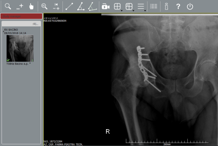 Esempio radiografia